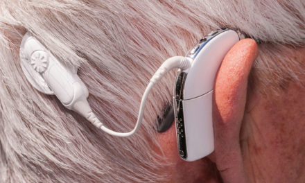 Pulsos de luz como nueva tecnología para estimular sensaciones auditivas en personas sordas